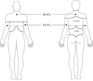 Figure 4  Most  painful  areas:  neck  and  shoulders  (back  and  front),  arms  and  hands (back and front), mid-back, low-back