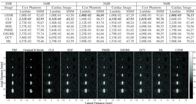 TABLE I: Deconvolution Results of Synthetic Ultrasound Images
