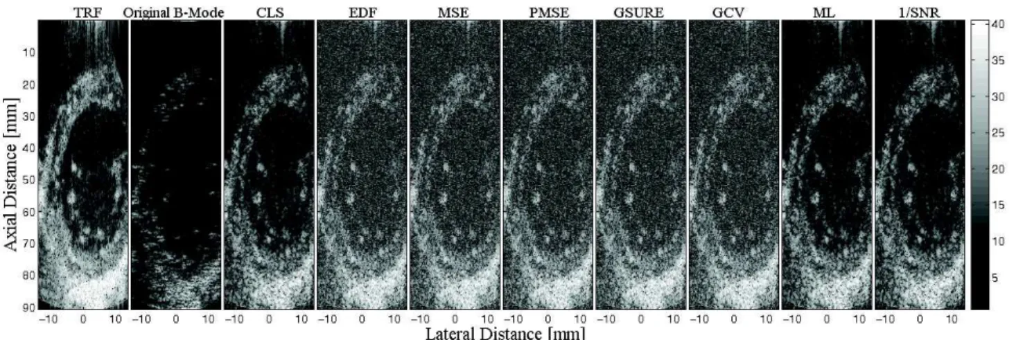 Fig. 2: SNR=30dB. From left to right, the images are Cardiac tissue reflectivity function, Cardiac B-mode US image and its deconvolution results (B-mode visualisation) for Q = Q 2DL .