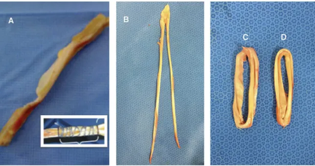 Figure 1. Samples of the different grafts studied. A ¼ PT and sPT, B ¼ GST4 before preparation, C ¼ ST4, D ¼ G4.
