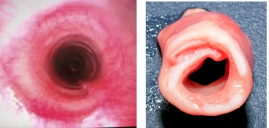 Figure 10: Trachée normale vue à l’endoscopie à gauche et hypoplasie trachéale à droite sur une pièce  anatomique de chien