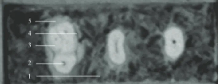 Figure 1. Example of CBCT slice obtained with the phantom developed in  this study: 1