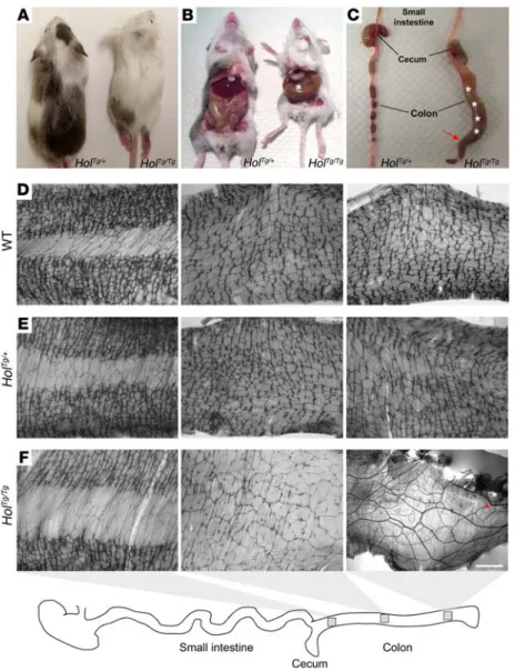 Figure 1. The Holstein mouse line is a model for agangli- agangli-onic megacolon. (A) Comparison between heterozygous  (Hol Tg/+ ) and homozygous (Hol Tg/Tg ) Holstein animals from  a F2 litter at P20, showing allele dosage-dependent  depigmentation