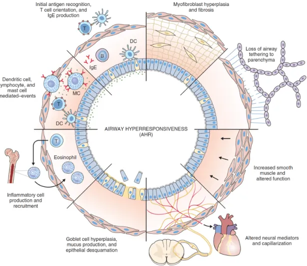 Figure  1.5 :  Les  différentes  causes  de  l’hyperréactivité  dans  l’asthme.  Parmi  les  différentes  causes  qui  peuvent  mener  à  l’hyperréactivité  bronchique  dans  l’asthme,  on  retrouve  une  augmentation  du  nombre  de  cellules  inflammatoi