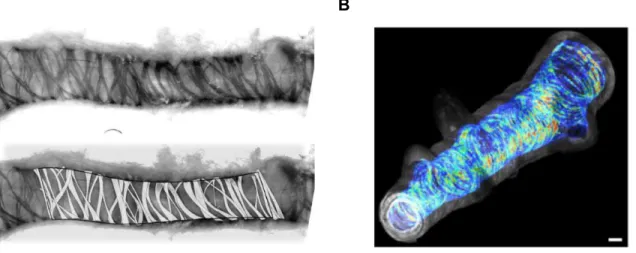 Figure  1.6 :  Le  muscle  lisse  des  voies  aériennes.  A  –  Bronche  humaine  périphérique  marquée à la phalloïdine conjuguée au TRITC, et observée en microscopie