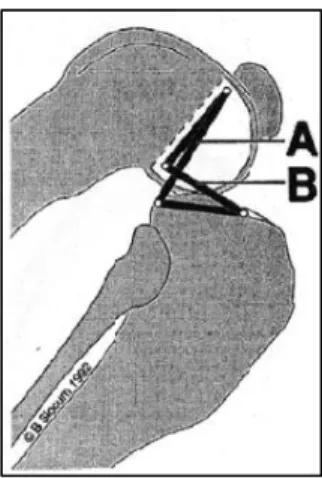 Figure 5 : Flexion du grasset et modélisation passive  59  A est le LCCa et B le LCCr 