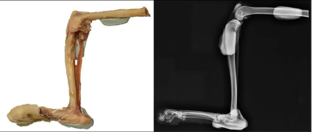 Figure 25: Positionnement du membre et radiographie de détermination de l'APT 