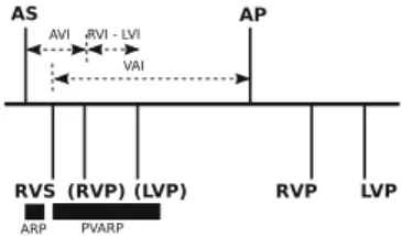 Fig. 2. Possible scenarios of the biventricular sensing and pacing. AS = atrial sensed; AP = atrial paced; LVS = left ventricular sensed; LVP