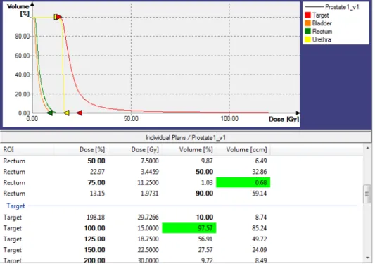 Figure 0.11 – DVH results and dosimetric parameter results (the recommended ones for evaluations are highlighted) of an optimal treatment plan for prostate cancer in Oncentra Brachy (top: cumulative DVHs, bottom: dosimetric parameters).