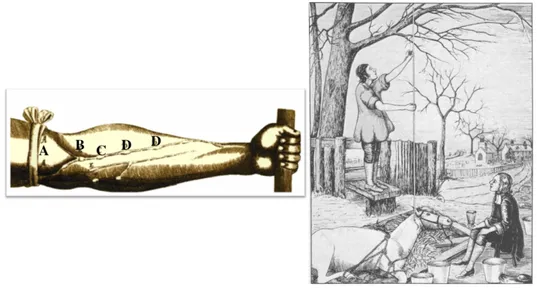 Figure 1 : Expérience du garrot d’Harvey. La compression du bras par un garrot en A fait ressortir  les  veines  de  l’avant-bras  entrainant  le  gonflement  des  valvules  B,  C  et  D  (à  gauche)  (McKenna  1987)