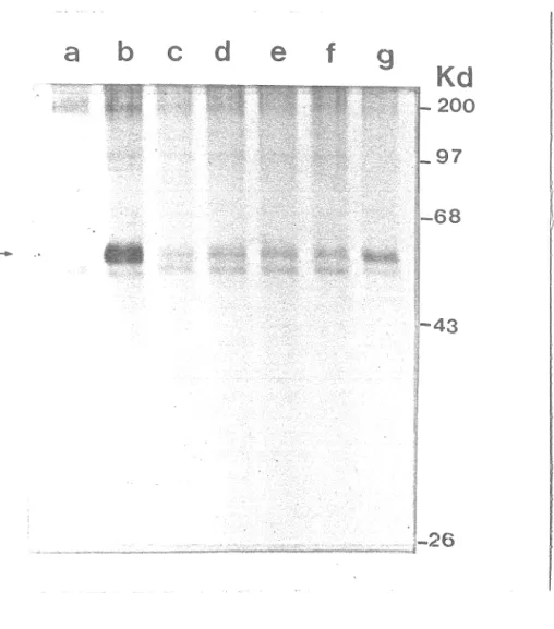 Figure  8.  Activité  kinasique  associée  à  T  moyen  dans  les  complexes  immuns  de  cellules  FR3T3  transformées  par  pPAB