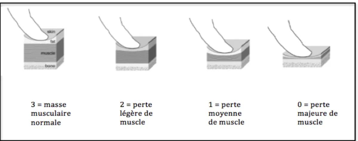 Figure 6 : Notation de l’état  musculaire  chez  le  chat  (BALDWIN  et  al,  2010 ; MICHEL et al, 2011) 