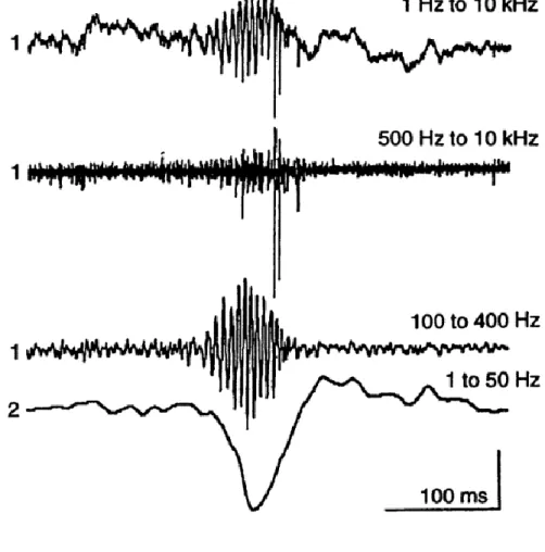 Figure 2: Sharp-wave ripple in the CA1 region of the hippocampus 