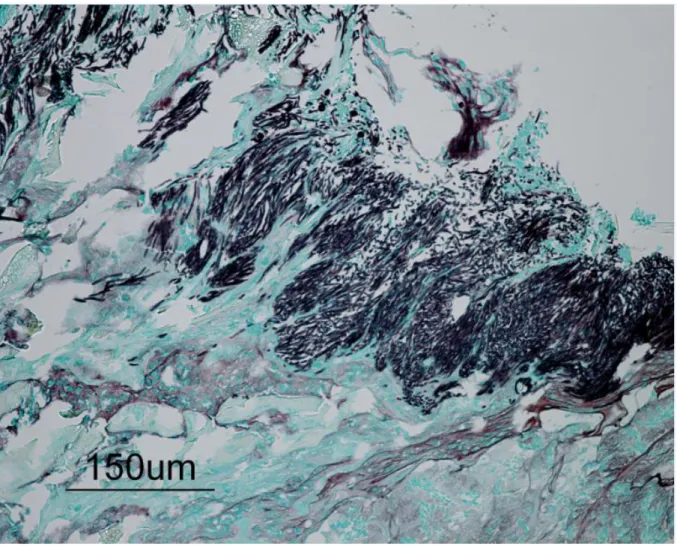 Figure  4  :  Coloration  de  Gomori-Grocott  sur  la  muqueuse  du  proventricule  d’une  perdrix  grise  (Perdix  perdix)