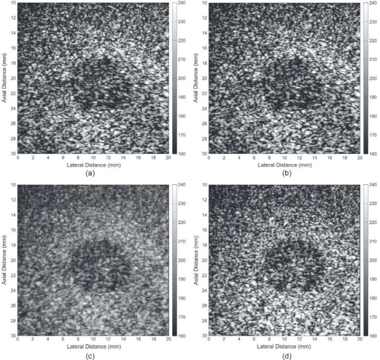 Fig. 6. Results of SR image reconstruction using various methods. (a) One of the 15 LR input images and the resulting HR output images using (b) a bicubic interpolation, (c) classic SR [10], and (d) our method.