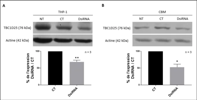 Figure 13 : Expression protéique de TBC1D25 dans les ostéoclastes humains et les cellules THP-1 