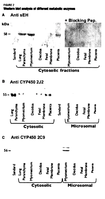 FIGURE 2. Western blot analysis of different subcellular fractions using antibodies against sEH,  CYP450-2J2 and CYP450-2C9
