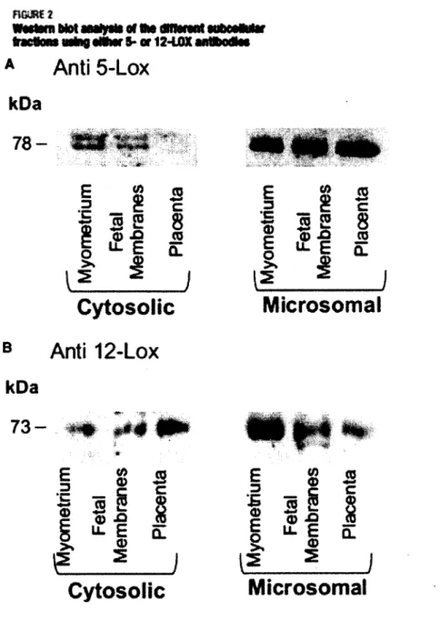 FIGURE 2. Western blot analysis of the different subcellular fractions using either 5- or 12- LOX  antibodies