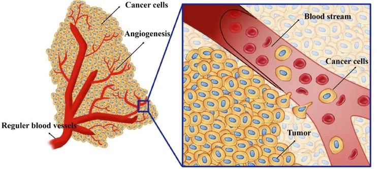 Figure 1.1. Schematic illustration of angiogenesis and the invasion of cancer into the blood  and lymphatic systems to enable invasion and metastasis adapted from cancer research UK  uploader [7, 8]