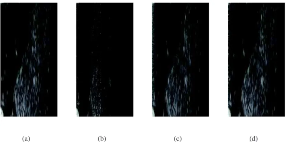 Fig. 2. Reconstruction results for a thyroid ultrasound image using 33% of the number of samples in the original