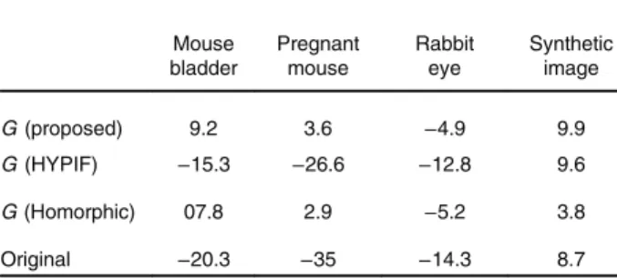 Table 4 Contrast-to-noise ratio in decibels. The higher, the better.