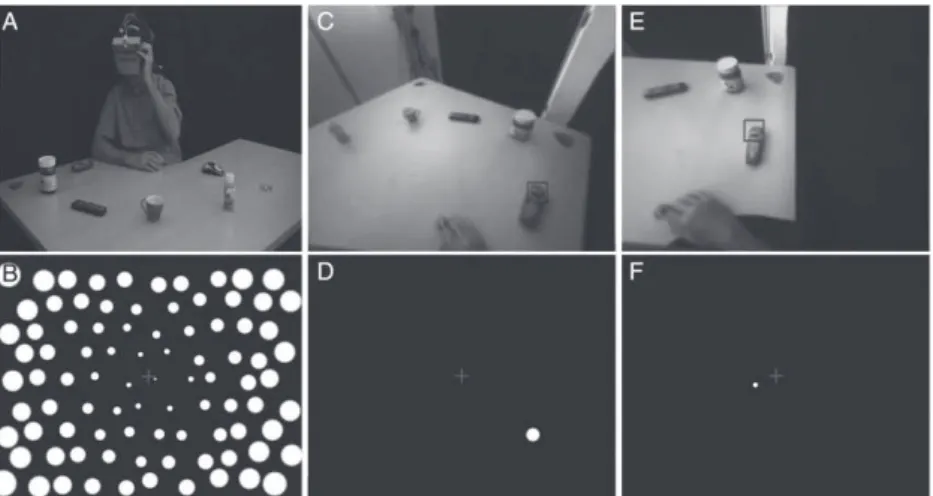 Figure 2C shows an example of a simulated implant, with 100 phosphenes spread over the visual field