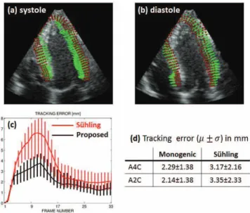 Fig. 4 . Estimated motion ﬁeld and corresponding tracked position of test points for a systolic (a) and a diastolic (b) frame of the simulated A4C sequence