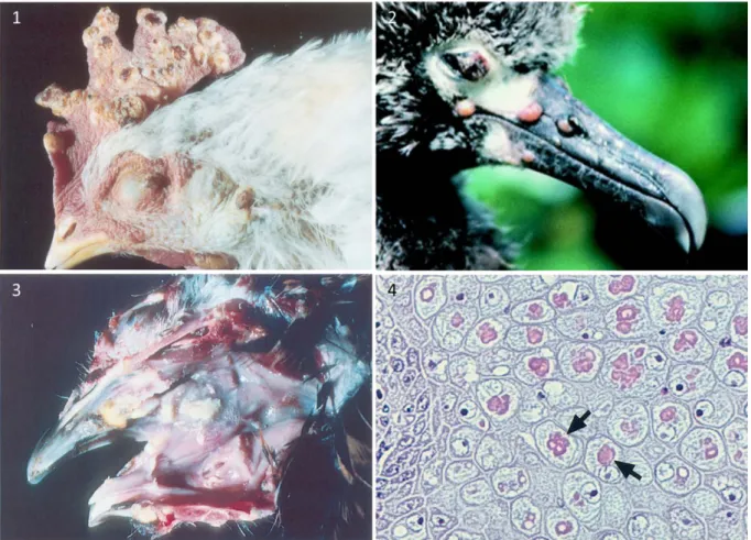 Figure 6. Lésions de variole aviaire : formes cutanées (1 et 2) et diphtérique (3), cellules  ballonisées contenant des inclusions intracytoplasmiques éosinophiles caractéristiques (4),  d’après Friend et al