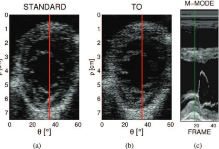Fig. 1. Comparison of standard beamforming and transverse oscillations: (a) and (b) compare the same frame of the SAx3 sequence in the two acquisition modalities while (c) illustrates the M-mode computed over one cardiac cycle on the scan-line represented 