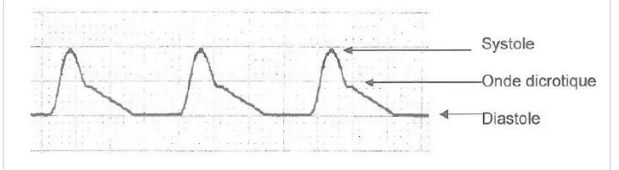 Figure 2. Exemple de courbe de pression artérielle.  Source de l’image: © Christian Godbout, 2012
