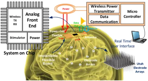 Figure 1.2 – An implantable brain computer interface.