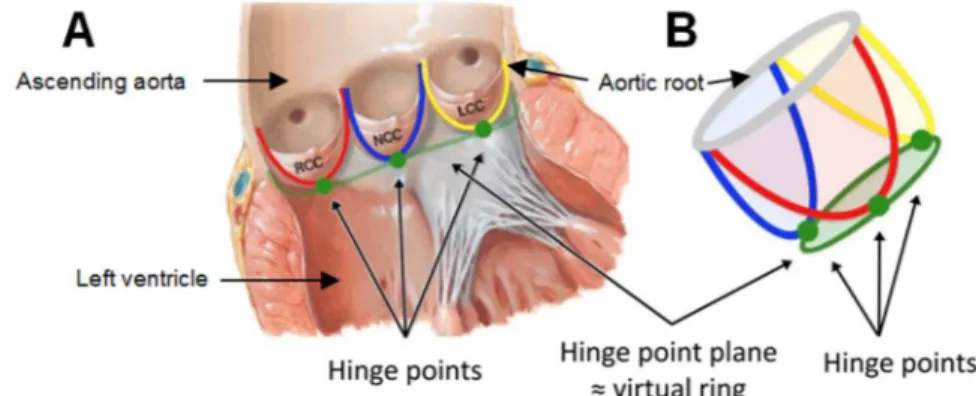 Figure 0.2 – Architecture de la racine aortique et de l’insertion des feuillets de la valve aortique