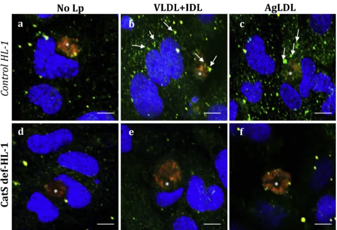 Fig. 4. Effect of VLDL + IDL and AgLDL on tropoelastin (TE) in control and CatS deﬁcient (CatS−) HL-1 cells