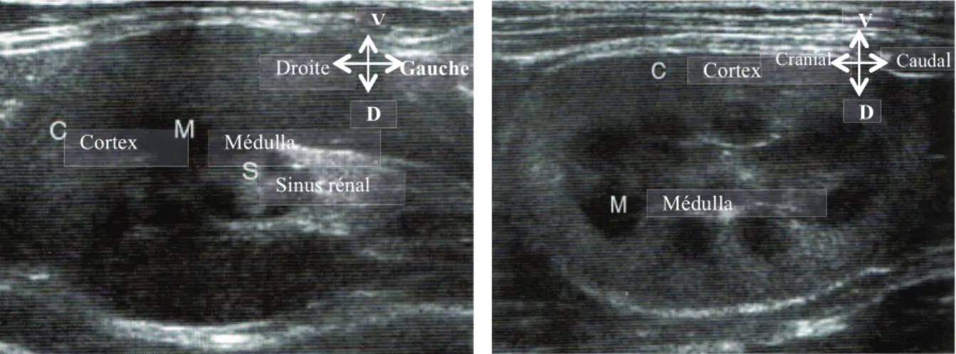 Figure 16 : Echographie du rein droit en coupe  transversale (O’Brien and Barr, 2009) 