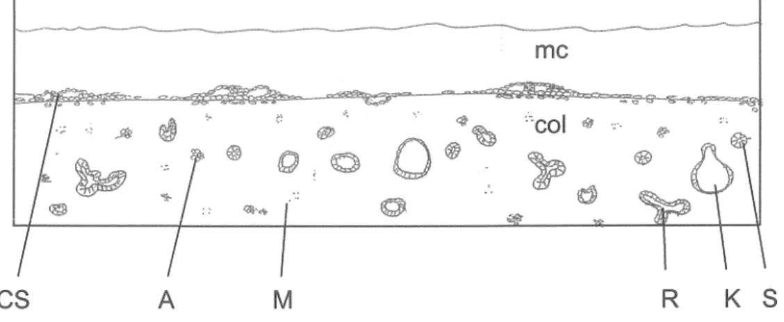 Figure 5.  Morphogenèse des NCI N87 en culture 3-D:  représentation schématique des structures observées 