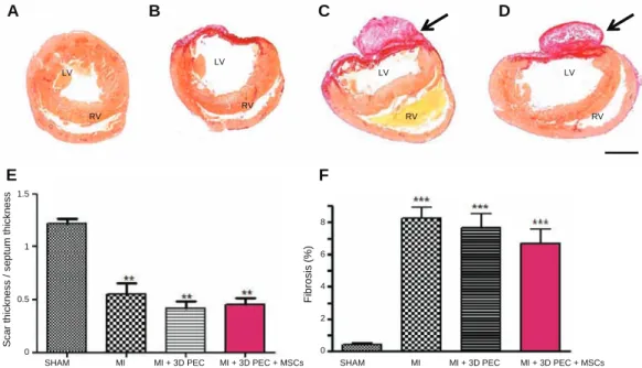 Fig. 8. Effect of 3D PEC scaffold implantation on myocardial fibrosis. Photomicrographs of myocardial sections stained with Sirius red of sham (A), infarcted rats without PEC scaffolds (B), implanted rats with PEC scaffolds without (C) and with MSCs (D)