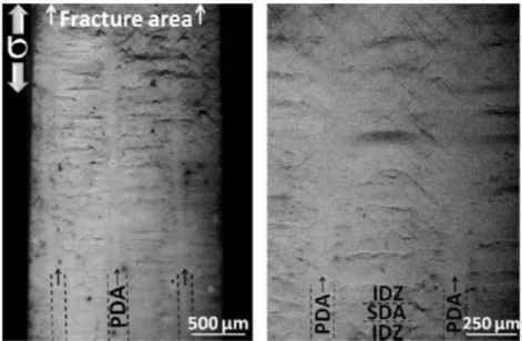Fig.  4.  Strain heterogeneity  distribution  observed  on a  creep-tested  sample  (optical  microscopy):  (a)  LTD-LD  observation of the entire width of the sample and (b) magnified image of area between two dendrite trunks