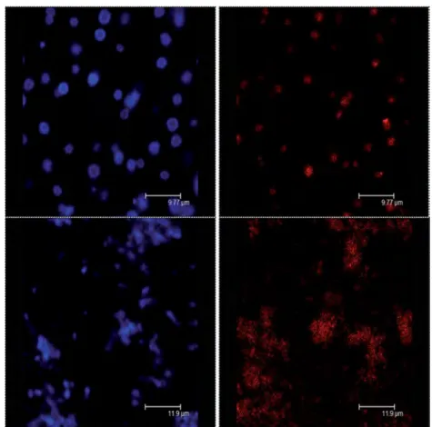 Fig. 3 Confocal microscopic observations before bead milling (upper pictures) and after bead milling (lower pictures)