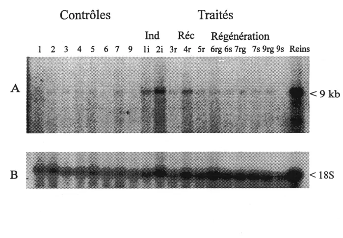 Figure 9. A. Analyse par Northern blot de 1'expression de FARNm du c-Met dans Ie pancreas de rats au cours d'une pancreatite aigue a long terme