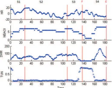 Fig. 13. Evolution of the three metrics for the participant HOSAL from the TUN = 1/0 group and associated TUN level computed by the trained ANFIS