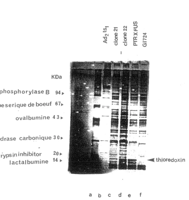 Figure 7:  Clonage  protéine  Les extraits  bactériens induits  pendant 4  à  30°C ont  été  analysés sur gel SDS PAGE,  et comparés&#34;  Piste c:  clone 21,  piste d:  clone22,  piste e:  vecteur pTRX FUS (contrôle),  piste  f:  bactéries GI724 (contrôle