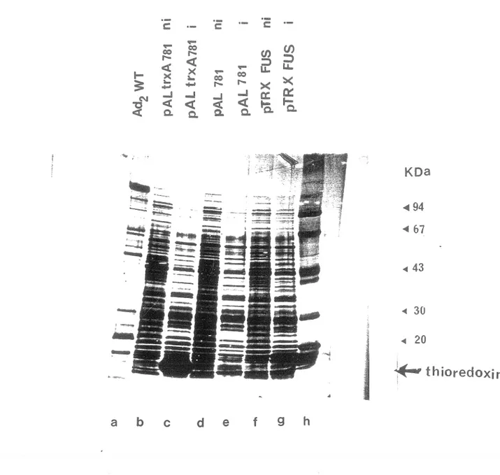 Figure  8:  Clonage  de  la  protéine  pVI.  Les  extraits  bactériens  non  induits  (ni)  ou  induits  (i)  au  tryptophane  pendant 4 heures  à 30°C ont été analysés  sur gel  SDS PAGE,  et  comparés