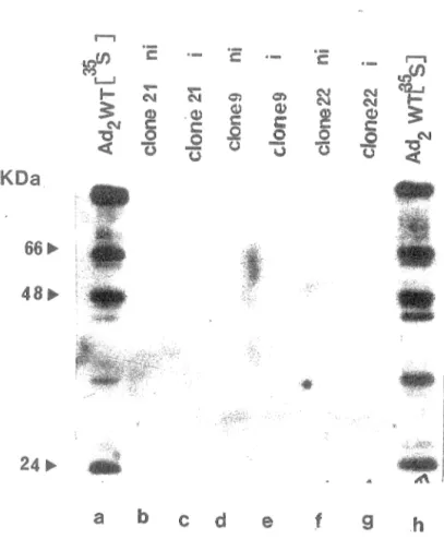 Figure 9:  Transfert sur filtre de nitrocellulose de protéines provenant de bactéries non induites  (ni)  et  au tryptophane  et  mises  en  présence  d'un  contenant des  anticorps  dirigés contre  la  protéine p  v'&#34;t  Les protéines ont été révélées 