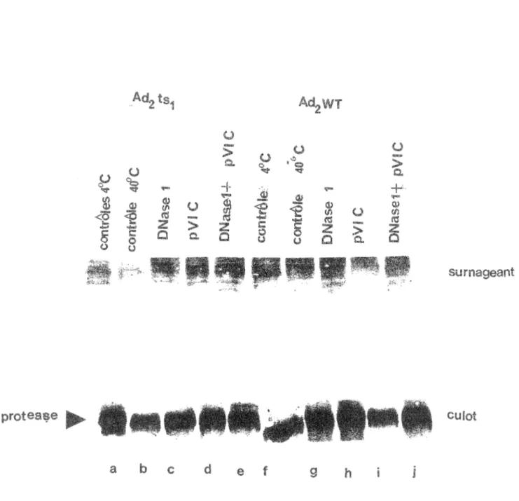 Figure 10: Etat de solubilité de  protéase. Les extraits nucléaires des cellules infectées par ad2  et ad2 wt ont  incubés à 4 °C (pistes a et  f)  et à 40°C (pistes b à e et g  à j), puis soumis  aux traitements suivants:  originaux (pistes b et g), en pr