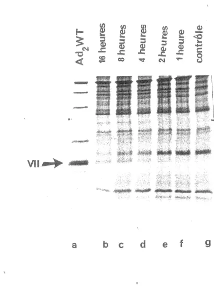 Figure 11: Effet du temps d'incubation sur l'activité protéolytique.  Les virions d 1 ad2 ts1  marqués  à  la  méthionine  35s  purifiés  et  fragrnentés  ont  été  incubés  à  37°C  avec  l'extrait  brut  bactérien pLPV pour des temps détenninés (piste f: