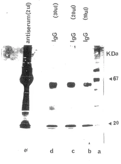 Figure 14: Purification des IgG du sérum de lapin.  Les  IgG du sérum de lapin ont été purifiées sur  une  DEAE  A..ffi-Gel  blue  (Kit  la  compagnie  Bio  RAD)  et  mis  sur  gel  PAGE-SDS