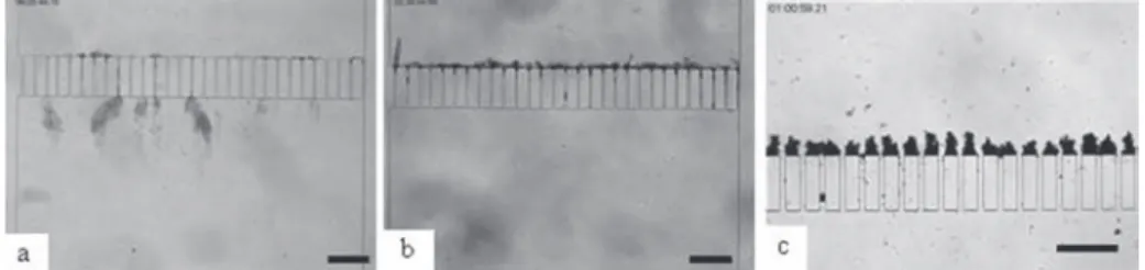 FIG. 5. Observation of clogging behavior after two hours of dead end filtration for the filtration of living E