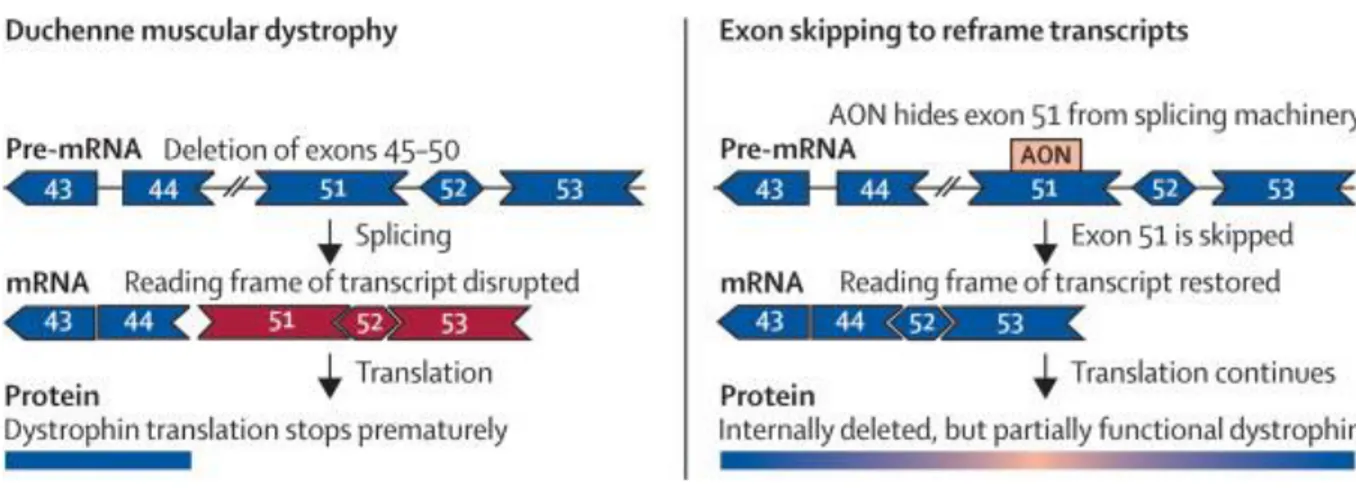 Figure  8.  Saut  d'exon  à  l'aide  d'AON  pour  restaurer  le  cadre  de  lecture  dans  l'ARNm  de  la  dystrophine 