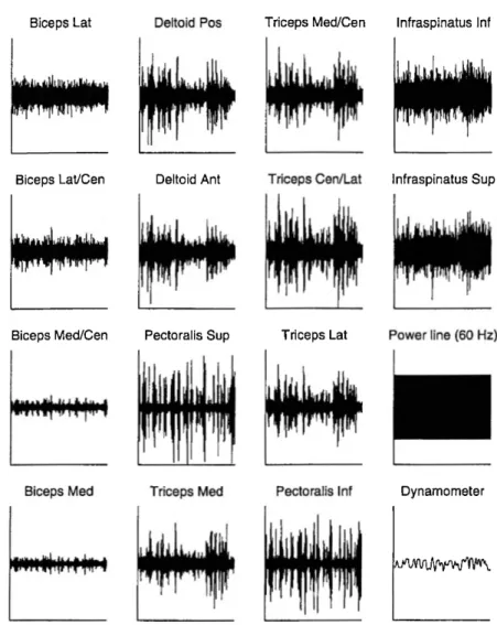 Figure  1.1: Exemple  de signaux électromyographiques  des différents  muscles.  Cette page montre tous  les signaux électromyographiques enregistrés  lors  d ’ un test