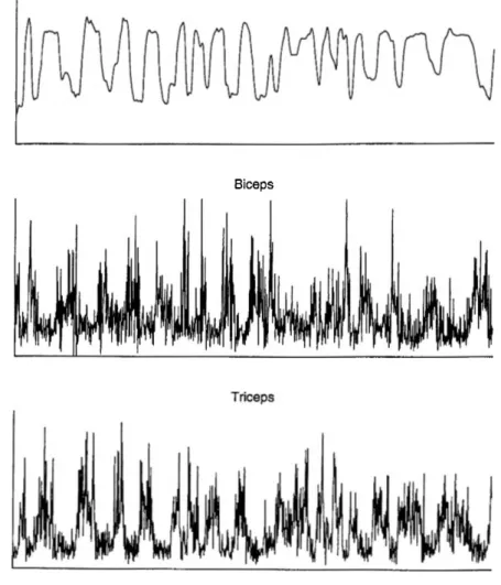 Figure 2.4: Exemple  du «Single  channel with  no adaptive whitening».